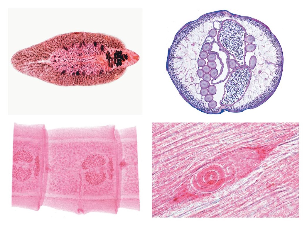 Parasitologie. Große Serie  50 Mikropräparate