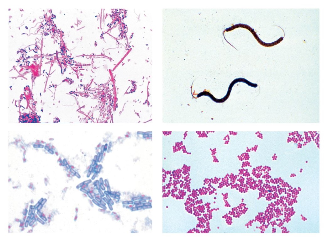 Bakterien. Basisserie, 25 Mikropräparate