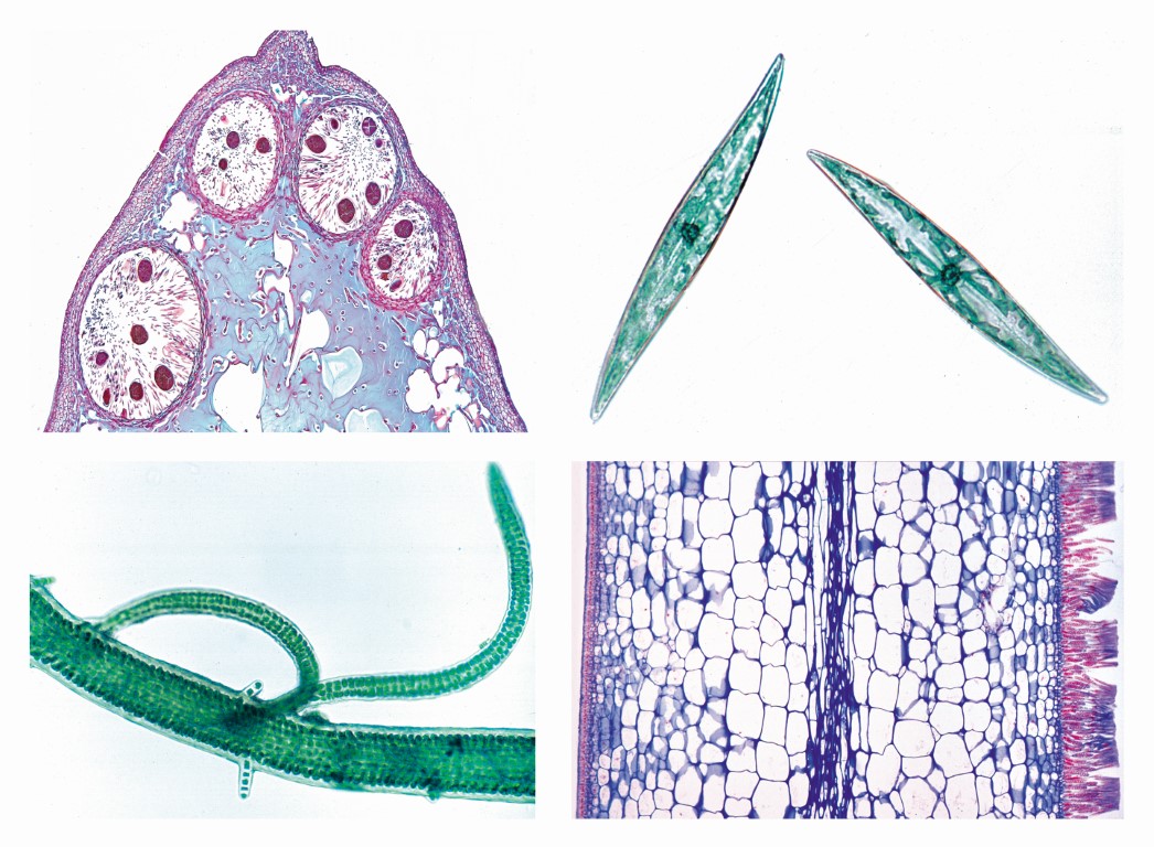 Mikropräparateserie Lebensraum Meerwasser, 15 Präparate