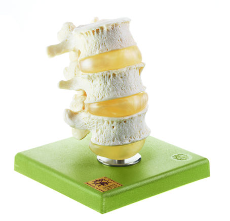 Drei Lendenwirbel mit Bandscheiben