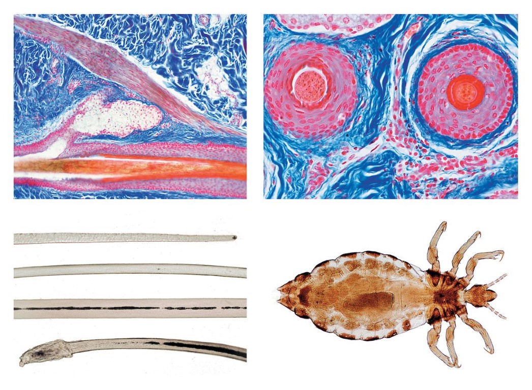 Kopfhaut und Haare des Menschen, 12 Mikropräparate