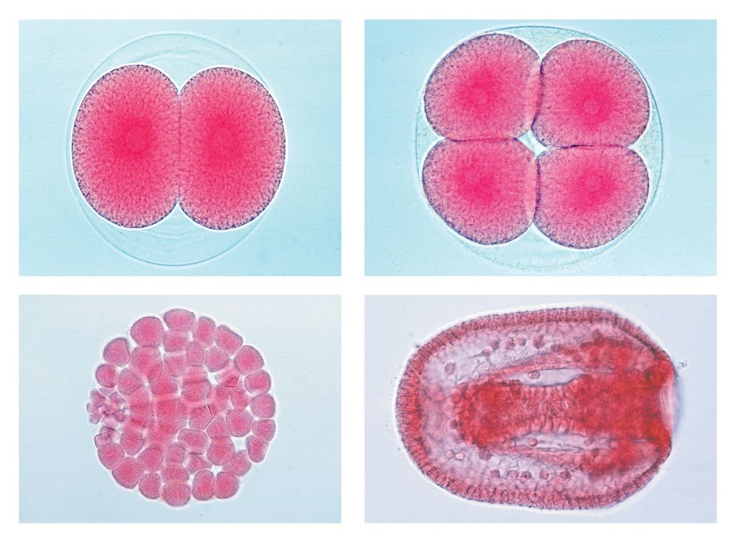 Entwicklung des Seeigels (Psammechinus miliaris), 12 Mikropräparate