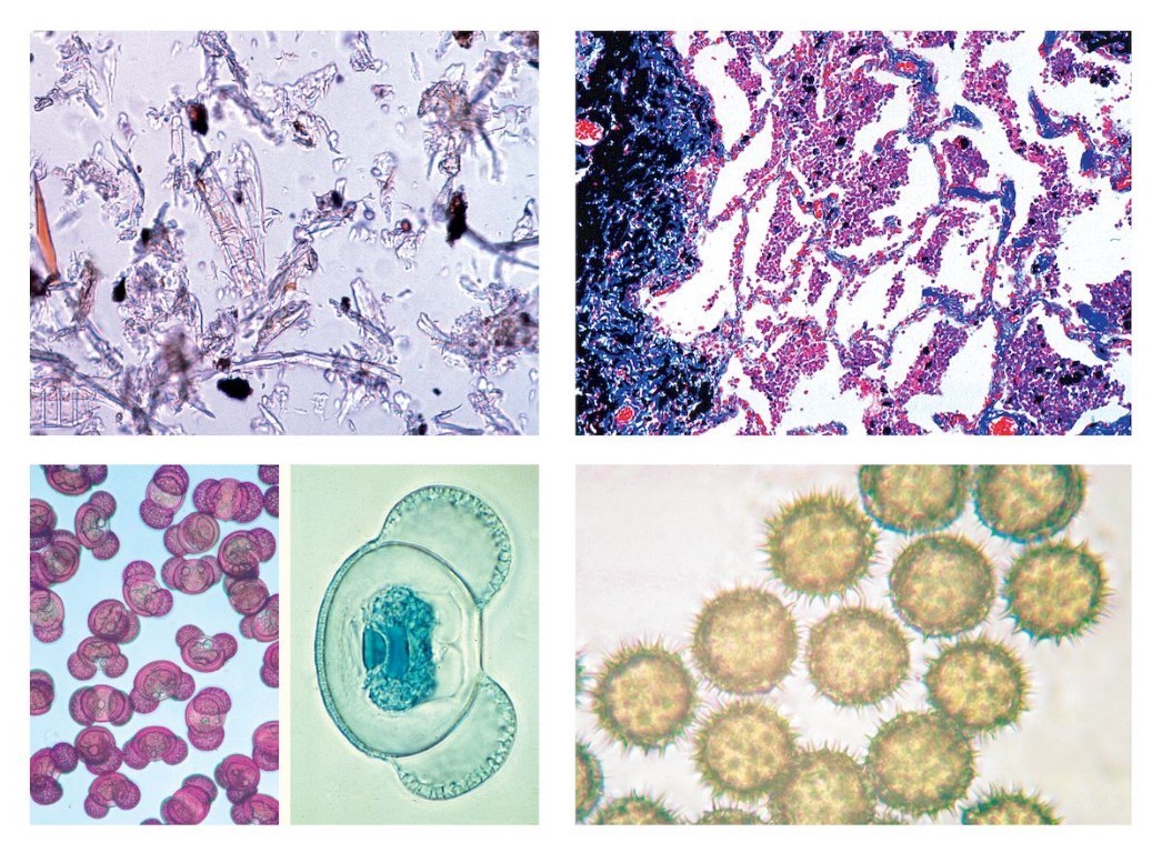 Unsere Umwelt IV. Die Luft, Luftverschmutzung und Allergene, 15 Mikropräparate