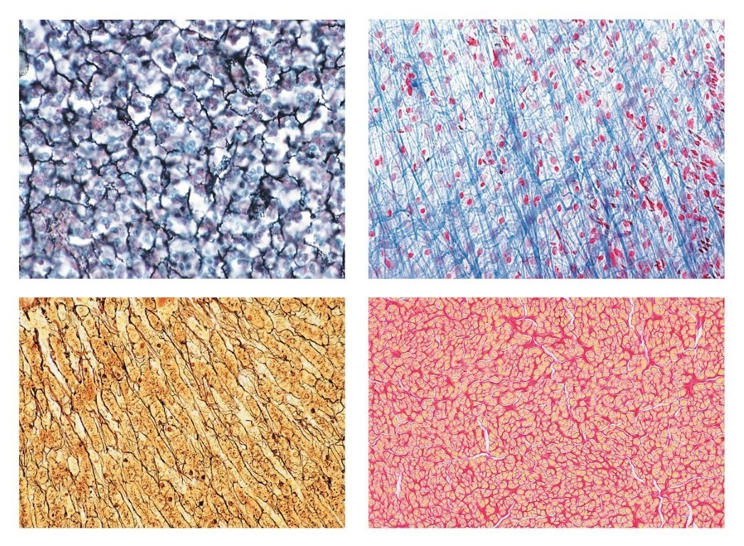 Histologie. Bindegewebe, 10 Mikropräparate