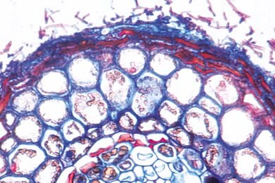 Fagus, Buche, Wurzel mit ektotropher Mykorrhiza, Schnitt